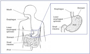 GER_GERD_Adults_GITract